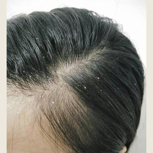 护发素没冲干净的表现（护发素没冲洗干净会怎样）