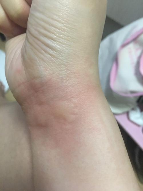 怎么不被蚊子咬（如何不被蚊子叮咬）