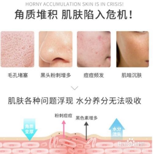 去角质对皮肤有什么好处（皮肤去角质的好处有哪些）
