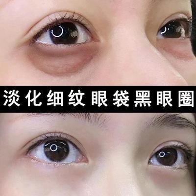 如何淡化黑眼圈（有什么办法可以淡化黑眼圈）