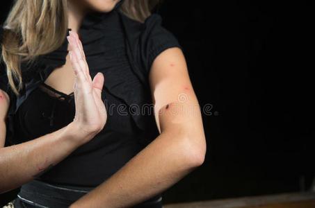 蚊子喜欢咬的8类人（蚊子喜欢咬什么人）